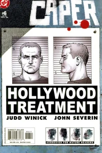 Hollywood Treatment, Part 2